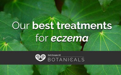 Our best treatments for eczema